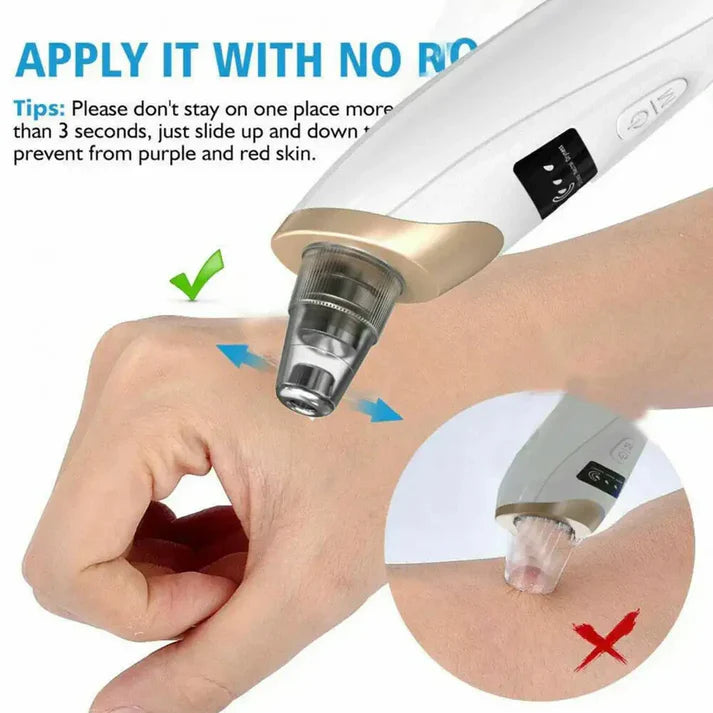 Rechargeable Blackhead Remover & Pore Cleanser